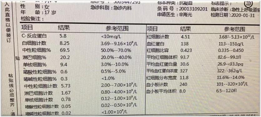 日本新冠肺炎最早动态及其早期影响分析